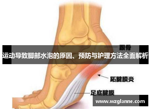 运动导致脚部水泡的原因、预防与护理方法全面解析